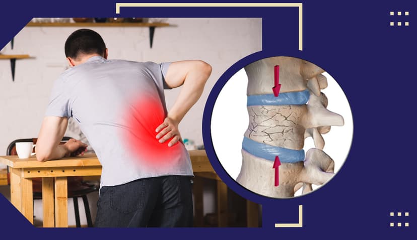 What Happens When the Spine Fractures