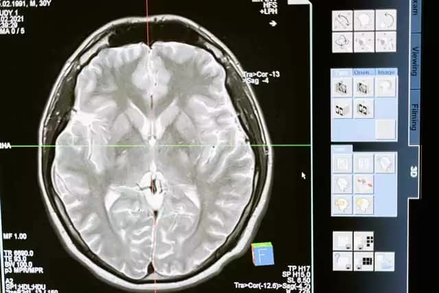 Diagnostic Imaging