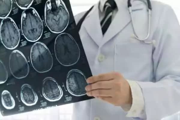 Neurologist